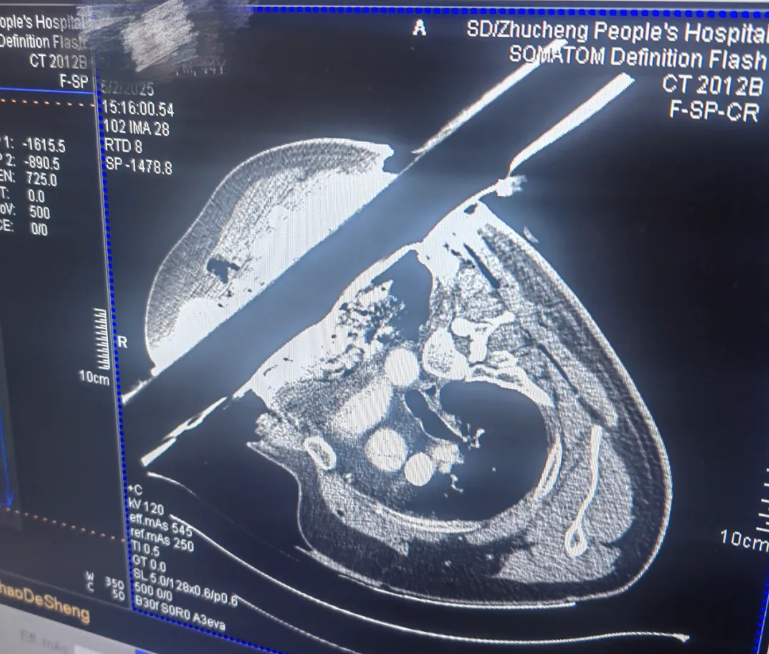 1760580278745373.png 1760580278745373.png