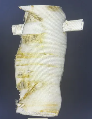 1760580301211245.png CT2.png