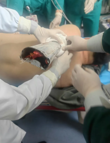 1760580353608694.png 钢管.png